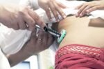 TickleFlex Insulin Pen Injection Aid – Universal Fit - Image 5